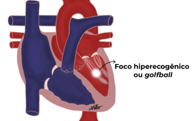 CORAÇÃO FETAL –  Golfball ou “bolinha de golfe”