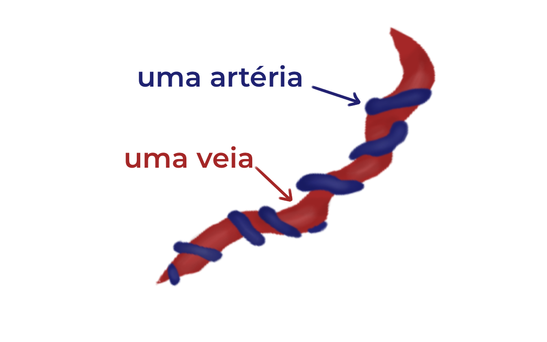 Artéria umbilical única