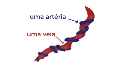 Artéria umbilical única